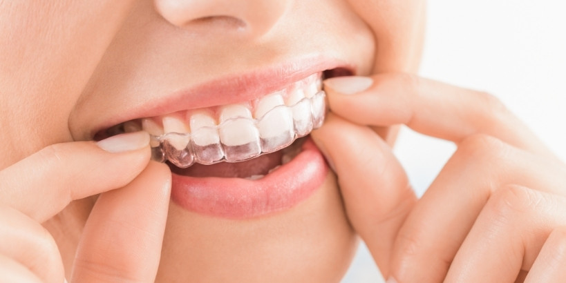 10 essential hacks to enhance your Invisalign experience